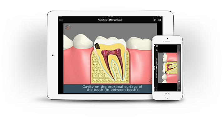 American Dental Software - 3d dental patient education app screenshot 2