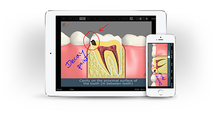 American Dental Software - 3d dental patient education app screenshot 3